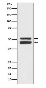 Anti-JNK1/JNK3 MAPK8 Rabbit Monoclonal Antibody Boster Bio