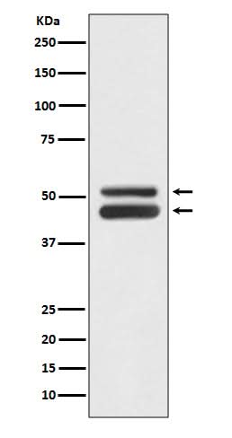 Anti-JNK1/JNK3 MAPK8 Rabbit Monoclonal Antibody Boster Bio