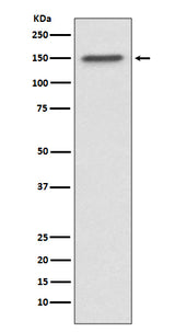 Anti-ASPP2 Rabbit Monoclonal Antibody Boster Bio