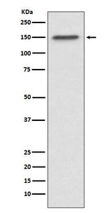 Anti-ASPP2 Rabbit Monoclonal Antibody Boster Bio