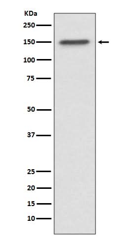 Anti-ASPP2 Rabbit Monoclonal Antibody Boster Bio