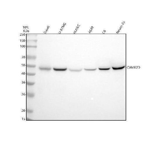 Anti-CaMKII delta CAMK2D Rabbit Monoclonal Antibody Boster Bio