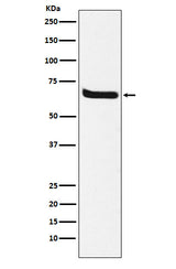 Anti-Klotho Rabbit Monoclonal Antibody Boster Bio