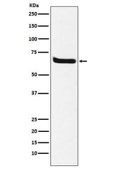 Anti-Klotho Rabbit Monoclonal Antibody Boster Bio
