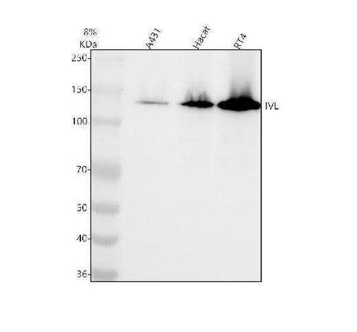 Anti-Involucrin IVL Rabbit Monoclonal Antibody Boster Bio