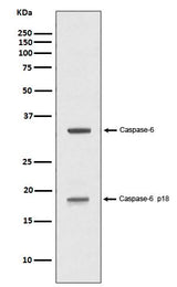 Anti-Caspase-6 p18 CASP6 Rabbit Monoclonal Antibody Boster Bio
