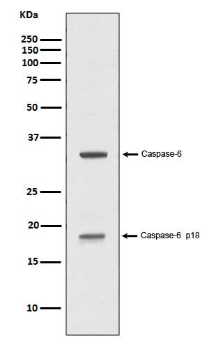 Anti-Caspase-6 p18 CASP6 Rabbit Monoclonal Antibody Boster Bio