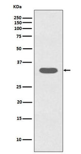 Anti-Caspase-6 CASP6 Rabbit Monoclonal Antibody Boster Bio