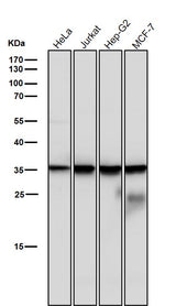 Anti-Caspase-6 Rabbit Monoclonal Antibody Boster Bio