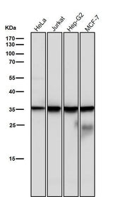 Anti-Caspase-6 Rabbit Monoclonal Antibody Boster Bio