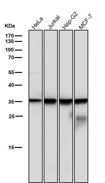Anti-Caspase-6 Rabbit Monoclonal Antibody Boster Bio