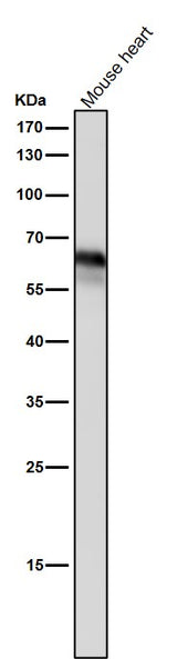 Anti-Yes1 Rabbit Monoclonal Antibody Boster Bio