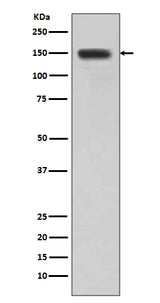 Anti-DSG1/Desmoglein 1 Rabbit Monoclonal Antibody Boster Bio
