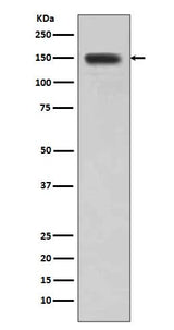 Anti-DSG1/Desmoglein 1 Rabbit Monoclonal Antibody Boster Bio