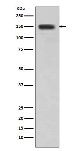 Anti-DSG1/Desmoglein 1 Rabbit Monoclonal Antibody Boster Bio