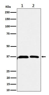 Anti-Serine racemase Rabbit Monoclonal Antibody Boster Bio