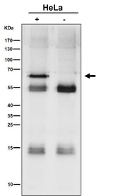 Anti-SYVN1 / HRD1 Rabbit Monoclonal Antibody Boster Bio