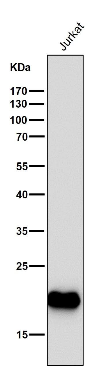 Anti-CD3 epsilon Rabbit Monoclonal Antibody Boster Bio