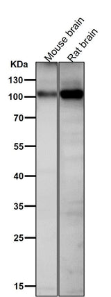 Anti-Phospho-AMPA Receptor 1 (S831) Rabbit Monoclonal Antibody Boster Bio