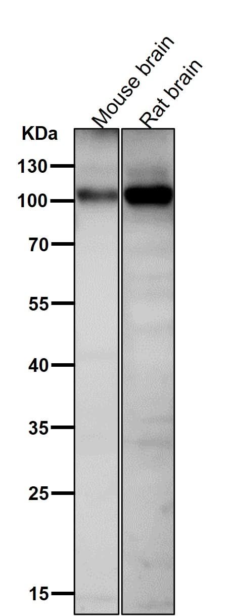 Anti-Phospho-AMPA Receptor 1 (S831) Rabbit Monoclonal Antibody Boster Bio