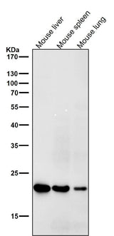 Anti-HE4 WFDC2 Rabbit Monoclonal Antibody Boster Bio
