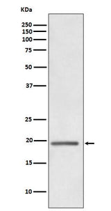 Anti-HE4 WFDC2 Rabbit Monoclonal Antibody Boster Bio