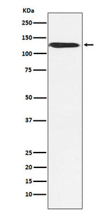Anti-SNF2H SMARCA5 Monoclonal Antibody Boster Bio