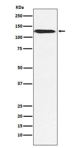 Anti-SNF2H SMARCA5 Monoclonal Antibody Boster Bio