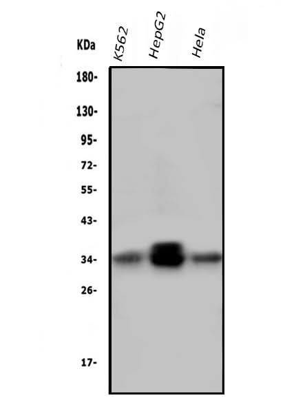 Anti-PPT1 Antibody Picoband® (monoclonal, 10F3 Boster Bio