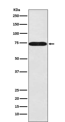 Anti-SNX1 Rabbit Monoclonal Antibody Boster Bio