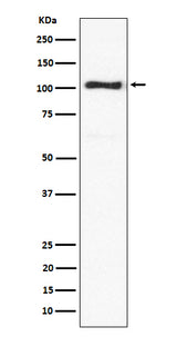 Anti-ACTN3 Rabbit Monoclonal Antibody Boster Bio
