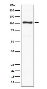 Anti-ACTN3 Rabbit Monoclonal Antibody Boster Bio