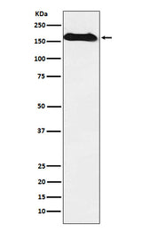 Anti-NAIP Rabbit Monoclonal Antibody Boster Bio