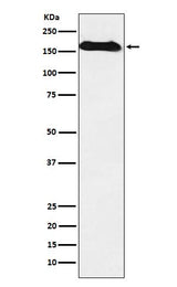 Anti-NAIP Rabbit Monoclonal Antibody Boster Bio