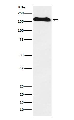 Anti-NAIP Rabbit Monoclonal Antibody Boster Bio