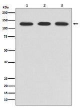 Anti-ABL2 Rabbit Monoclonal Antibody Boster Bio