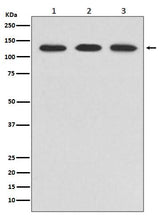 Anti-ABL2 Rabbit Monoclonal Antibody Boster Bio