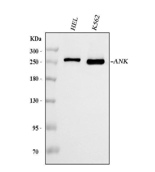 Anti-Ankyrin erythroid/ANK/ANK1 Antibody Picoband® (monoclonal, 9I6C3 Boster Bio