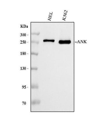 Anti-Ankyrin erythroid/ANK/ANK1 Antibody Picoband® (monoclonal, 9I6C3 Boster Bio