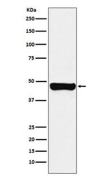 Anti-RCC1 Rabbit Monoclonal Antibody Boster Bio