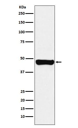 Anti-RCC1 Rabbit Monoclonal Antibody Boster Bio