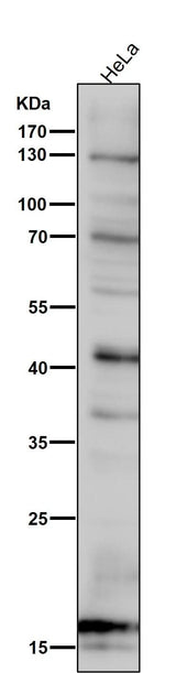 Anti-SDHC Rabbit Monoclonal Antibody Boster Bio