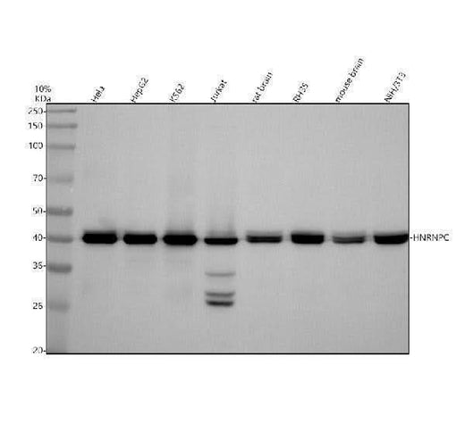 Anti-hnRNP C1/C2 Rabbit Monoclonal Antibody Boster Bio