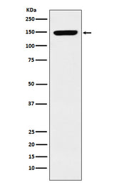 Anti-p150 CAF1 Rabbit Monoclonal Antibody Boster Bio
