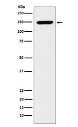 Anti-p150 CAF1 Rabbit Monoclonal Antibody Boster Bio
