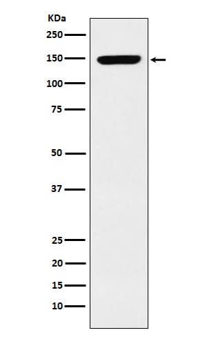 Anti-p150 CAF1 Rabbit Monoclonal Antibody Boster Bio