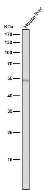 Anti-ACM2 Rabbit Monoclonal Antibody Boster Bio