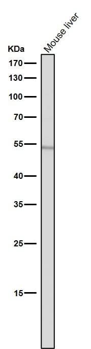 Anti-ACM2 Rabbit Monoclonal Antibody Boster Bio
