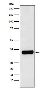 Anti-PRKRA Rabbit Monoclonal Antibody Boster Bio
