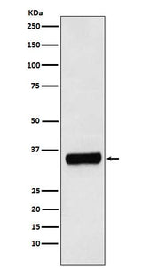 Anti-PRKRA Rabbit Monoclonal Antibody Boster Bio